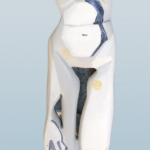 Figur, weibl. (2004)